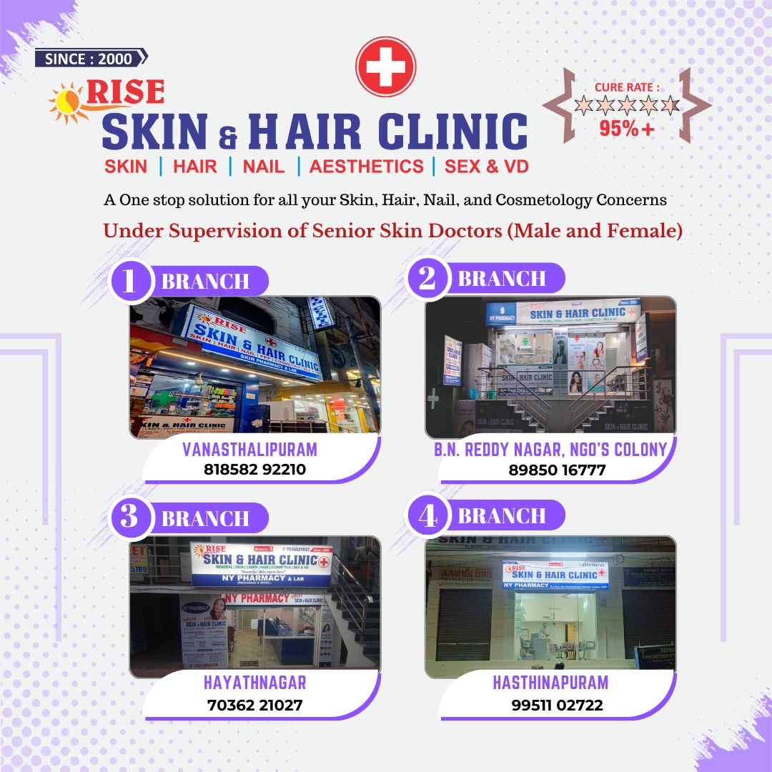 Dermatologist Consultation